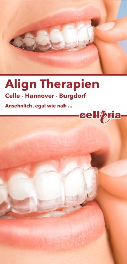 Invisalign Therapie - Vergrößerung der Zahnspange um diese sehen zu können